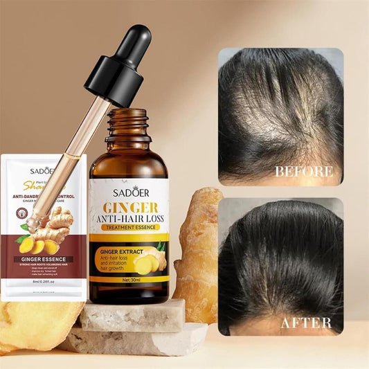 Hair Growth Serum - 30ml