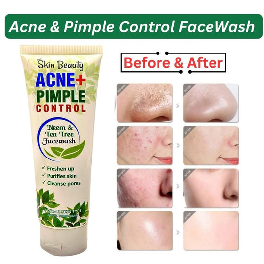 Anti-Acne Face Wash